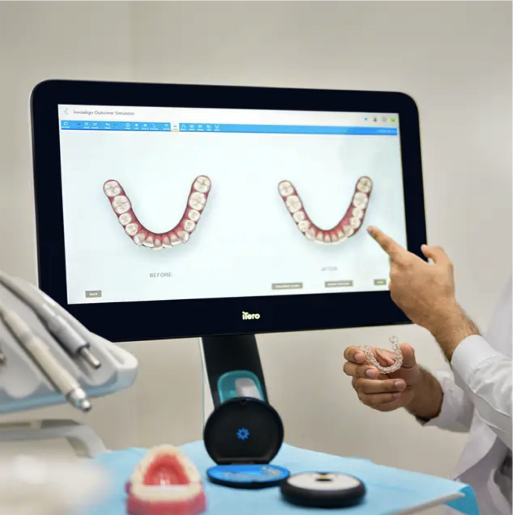 Invisalign in Gurgaon